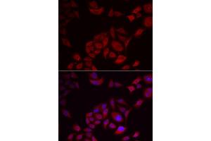 Immunofluorescence analysis of U2OS cells using PIKFYVE antibody (ABIN5974035).