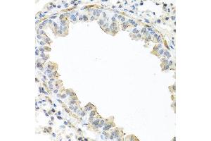 Immunohistochemistry of paraffin-embedded mouse lung using IL22 antibody at dilution of 1:100 (40x lens).