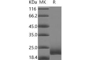 Western Blotting (WB) image for Fc Fragment of IgG, Low Affinity IIIb, Receptor (CD16b) (FCGR3B) (Active) protein (Biotin) (ABIN7195709) (FCGR3B Protein (Biotin))