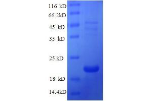 SDS-PAGE (SDS) image for Ephrin A1 (EFNA1) (AA 18-182) protein (His tag) (ABIN5709441)