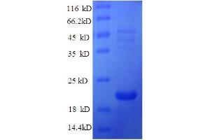 SDS-PAGE (SDS) image for Ephrin A1 (EFNA1) (AA 18-182) protein (His tag) (ABIN5709441) (Ephrin A1 Protein (EFNA1) (AA 18-182) (His tag))