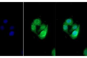 Detection of UMOD in Human Hela cell using Polyclonal Antibody to Uromodulin (UMOD) (Uromodulin Antikörper  (AA 334-589))