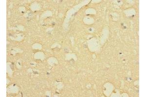 Immunohistochemistry of paraffin-embedded human brain tissue using ABIN7163876 at dilution of 1:100 (WBSCR17 Antikörper  (AA 101-300))