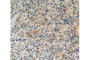 Used in DAB staining on fromalin fixed paraffin- embedded kidney cancer tissue (BCL2L1 Antikörper  (AA 2-212))
