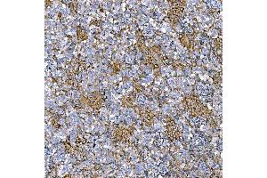 IHC analysis of RAB7/RAB7A using anti-RAB7/RAB7A antibody (ABIN7600597).