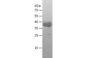 Western Blotting (WB) image for Collagen, Type I, alpha 1 (COL1A1) (AA 23-161) protein (His-IF2DI Tag) (ABIN7122499)