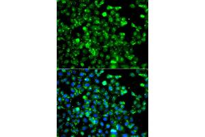 Immunofluorescence analysis of A549 cell using CAPN5 antibody. (Calpain 5 Antikörper)