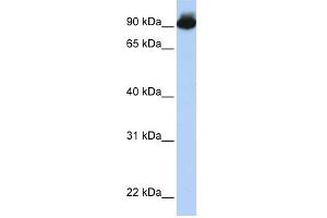 ELMO3 antibody used at 1 ug/ml to detect target protein. (ELMO3 Antikörper  (Middle Region))