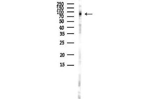 Western blot analysis of lysates from Rat brain, using Phospho-NLRP3 (Ser194) Antibody at 1/1000 dilution.