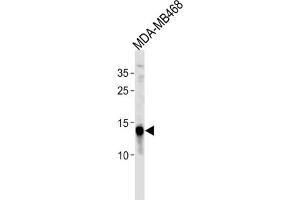 Western Blotting (WB) image for anti-Tumor Protein D52-Like 3 (TPD52L3) antibody (ABIN3004710) (TPD52L3 Antikörper)