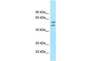 ATG16L1 antibody used at 1 ug/ml to detect target protein. (ATG16L1 Antikörper)