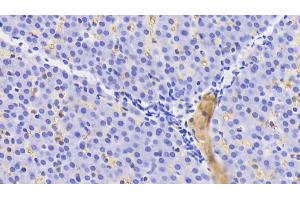 Immunohistochemistry (IHC) image for anti-Hemoglobin antibody (ABIN7437245)