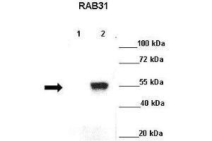 Lanes : Lane 1: GFP-Rab5 transfected cos cellsLane 2: GFP-Rab31 transfected cos cells  Primary Antibody Dilution :  1:500   Secondary Antibody : Goat anti rabbit-HRP  Secondary Antibody Dilution :  1:5000  Gene Name : RAB31  Submitted by : Ruth Herbst, Medical University Vienna (RAB31 Antikörper  (C-Term))