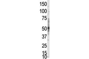 Western Blotting (WB) image for anti-Protein Arginine Methyltransferase 3 (PRMT3) (AA 142-173) antibody (ABIN3032358)