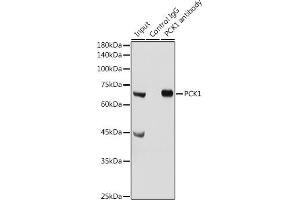 Immunoprecipitation analysis of 300 μg extracts of Mouse liver cells using 3 μg PCK1 antibody (ABIN3022753, ABIN3022754, ABIN3022755 and ABIN6219210). (PCK1 Antikörper  (C-Term))