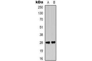 Western blot analysis of BCL2 (pT56) expression in Jurkat (A), rat muscle (B) whole cell lysates. (Bcl-2 Antikörper  (pSer56))
