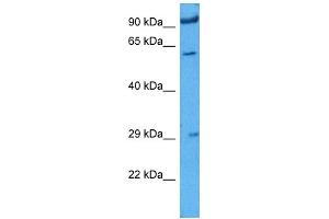 Host:  Rabbit  Target Name:  IGF2BP1  Sample Tissue:  Rat Skeletal Muscle  Antibody Dilution:  1ug/ml (IGF2BP1 Antikörper  (N-Term))