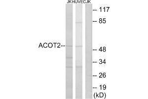 Western blot analysis of extracts from Jurkat cells and HuvEc cells, using ACOT2 antibody. (ACOT2 Antikörper  (Internal Region))