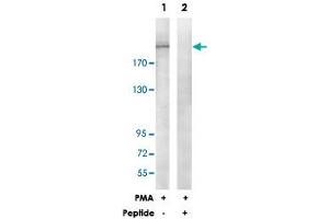 Western blot analysis of extracts from HepG2 cells, treated with PMA (125 ng/mL, 30 mins), using ITGB4 polyclonal antibody .