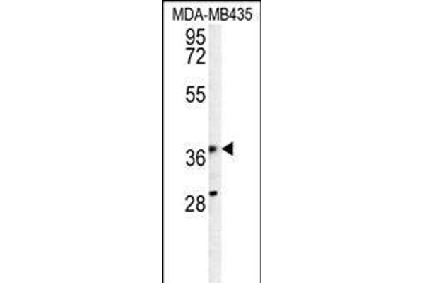 PRPSAP1 Antikörper  (N-Term)