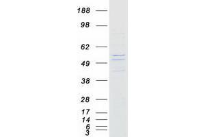 Validation with Western Blot (KLHDC7B Protein (Myc-DYKDDDDK Tag))