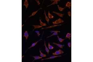 Immunofluorescence analysis of L929 cells using RPE Polyclonal Antibody (ABIN7270048) at dilution of 1:100 (40x lens). (RPE Antikörper  (AA 1-228))