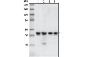 Western blot analysis using CHK1 mouse mAb against A431 (1), Hela (2), NIH/3T3 (3) and K562 (4) cell lysate. (CHEK1 Antikörper)