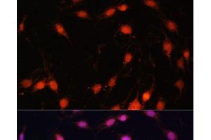 Immunofluorescence analysis of C6 cells using ZNF416 Polyclonal Antibody at dilution of 1:100.