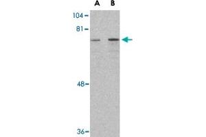 Western blot analysis of DDX3X in HepG2 cell lysate with DDX3X polyclonal antibody  at (A) 1 and (B) 2 ug/mL . (DDX3X Antikörper  (Internal Region))
