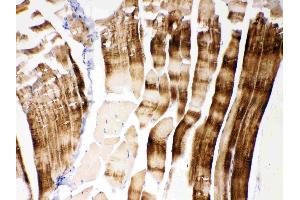 IHC analysis of ACTN3/Alpha Actinin 3 using anti- ACTN3/Alpha Actinin 3 antibody . (ACTN3 Antikörper  (C-Term))