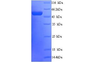 SDS-PAGE (SDS) image for Peter Pan Homolog (PPAN) (AA 1-473), (full length) protein (His tag) (ABIN5714474)