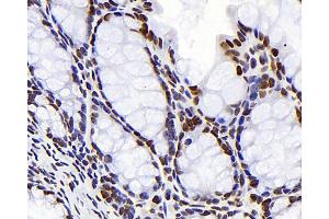 Immunohistochemistry analysis of paraffin-embedded mouse colon using S100A4 Monoclonal Antibody at dilution of 1:300. (s100a4 Antikörper)