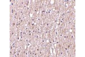 Immunohistochemistry of TWEAK in human brain tissue with this product at 10 μg/ml.
