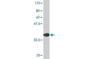 Western Blot detection against Immunogen (37. (ZBTB14/ZFP161 Antikörper  (AA 311-420))