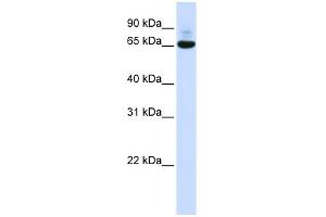 WB Suggested Anti-CNOT4 Antibody Titration:  0. (CNOT4 Antikörper  (N-Term))