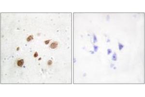 Immunohistochemistry (IHC) image for anti-Pregnancy Up-Regulated Non-Ubiquitously Expressed CaM Kinase (PNCK) (AA 161-210) antibody (ABIN2889644) (PNCK Antikörper  (AA 161-210))