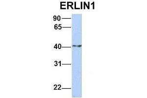 Host:  Rabbit  Target Name:  ERLIN1  Sample Type:  Human MCF7  Antibody Dilution:  1. (ERLIN1 Antikörper  (N-Term))