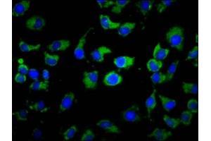 Immunofluorescence staining of A549 cells with ABIN7155184 at 1:133, counter-stained with DAPI.