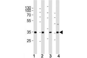 Western blot analysis of lysate from (1) human HeLa cell line, (2) mouse spleen, (3) rat lung, (4) rat stomach tissue using Cyclin D3 antibody at 1:1000. (Cyclin D3 Antikörper  (AA 33-66))