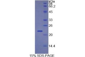 SDS-PAGE analysis of Human CDKN1A Protein. (p21 Protein)