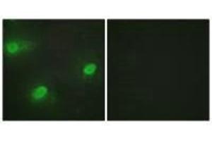 Immunofluorescence analysis of HeLa cells, using CSTF2 antibody. (CSTF2 Antikörper  (N-Term))