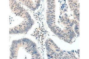 Immunohistochemistry (IHC) image for anti-TNF Receptor-Associated Factor 7 (TRAF7) antibody (ABIN3023478) (TRAF7 Antikörper)