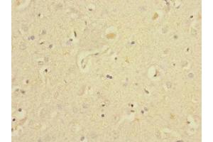 Immunohistochemistry of paraffin-embedded human brain tissue using ABIN7151514 at dilution of 1:100 (EAF2 Antikörper  (AA 1-170))