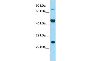 Western Blotting (WB) image for anti-Peptidyl Arginine Deiminase, Type VI (PADI6) (N-Term) antibody (ABIN2790272)
