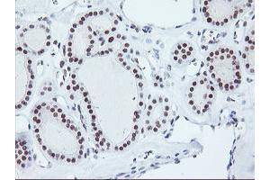 Image no. 5 for anti-Ring Finger Protein 113B (RNF113B) antibody (ABIN1500718) (RNF113B Antikörper)