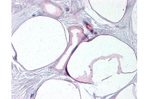 Anti-FABP4 antibody IHC of human breast, adipocytes.