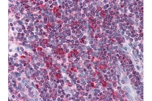 Immunohistochemical analysis of paraffin-embedded human Liver tissues using Metadherin mouse mAb (MTDH Antikörper)