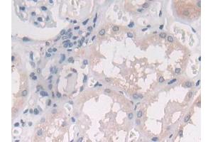 DAB staining on IHC-P; Samples: Human Kidney Tissue (IL-25 Antikörper  (AA 28-177))