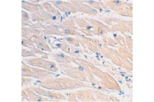 Immunohistochemical staining of human heart tissue using MYD88 polyclonal antibody  at 2 ug/mL . (MYD88 Antikörper  (AA 233-248))