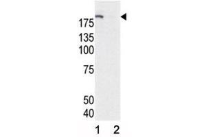 Western blot analysis of phospho-EGFR antibody and HeLa cell lysate, either induced (Lane 1) or noninduced with EGF (2). (EGFR Antikörper  (pTyr1172))